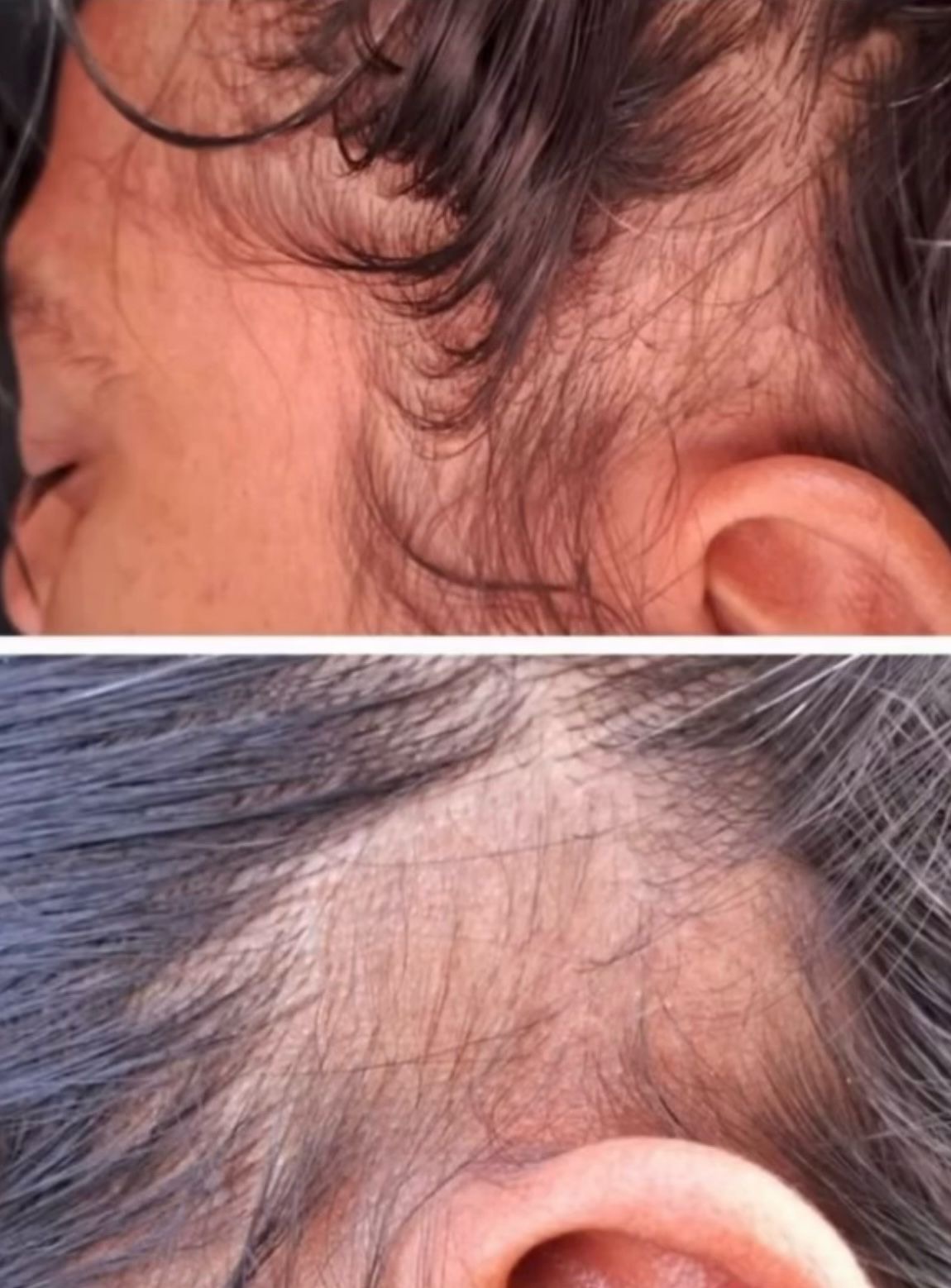 hair_before