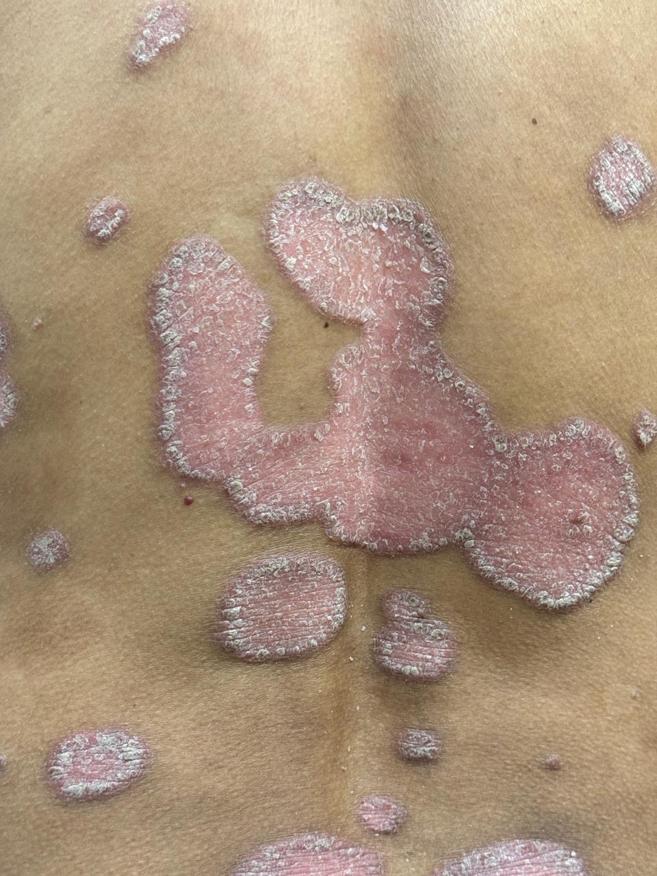 skin1